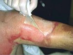 Plastic and Burn Surgery -...