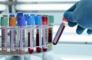 Biochemistry Test - GULSHAN CLINIC LTD