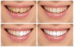 Cosmetic Dentistry - Rifats Dental