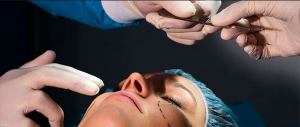 Burn and Plastic Surgery - MMC