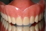 Denture  -  Johnsons Place...