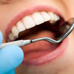 Dental Crowns - Ratans Dental...