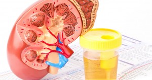 URINE Test-GULSHAN CLINIC LTD