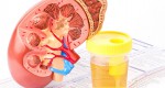 URINE Test-GULSHAN CLINIC LTD