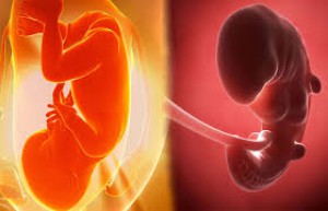 Gynecology - Naz-E-Noor Hospital (Pvt) Ltd.