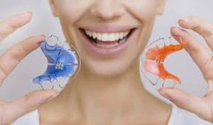 Hawley retainer - Johnsons Place Dental Lab