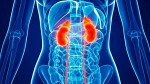 Dialysis Department - Central...