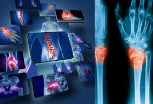 Orthopedics Surgery - Ibn Hospital