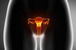 Gynae Oncology - Delta...