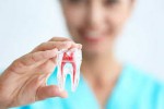 Root Canal Treatment - Aiko...