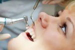 Periodontal scaling - Johnsons...