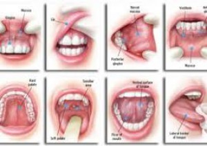 Oral Cancer - Avenue Dental Care