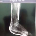 More Images