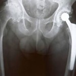 More Images